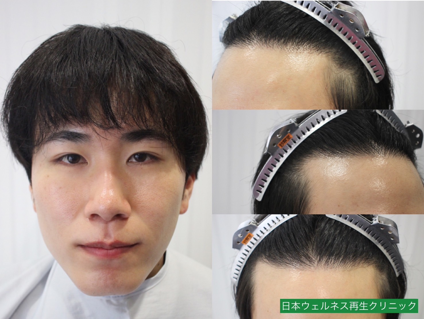 S・Nさん　20代男性【FUT】1300株