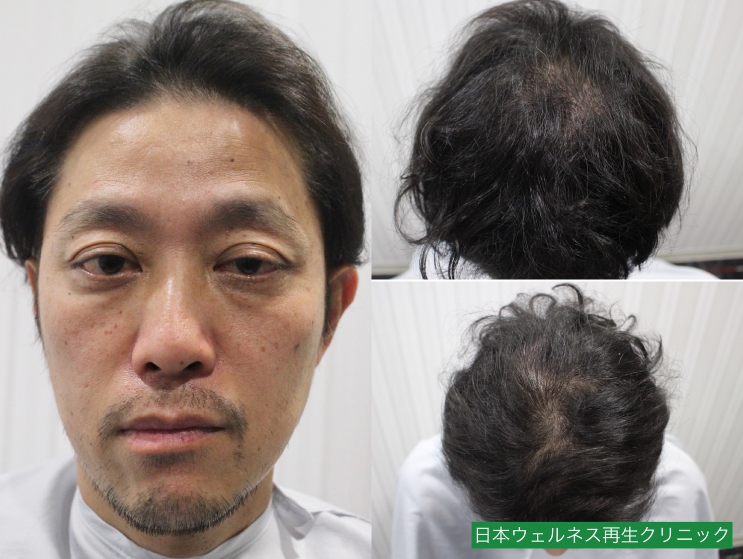 K・Hさん　40代男性【FUT】1300株