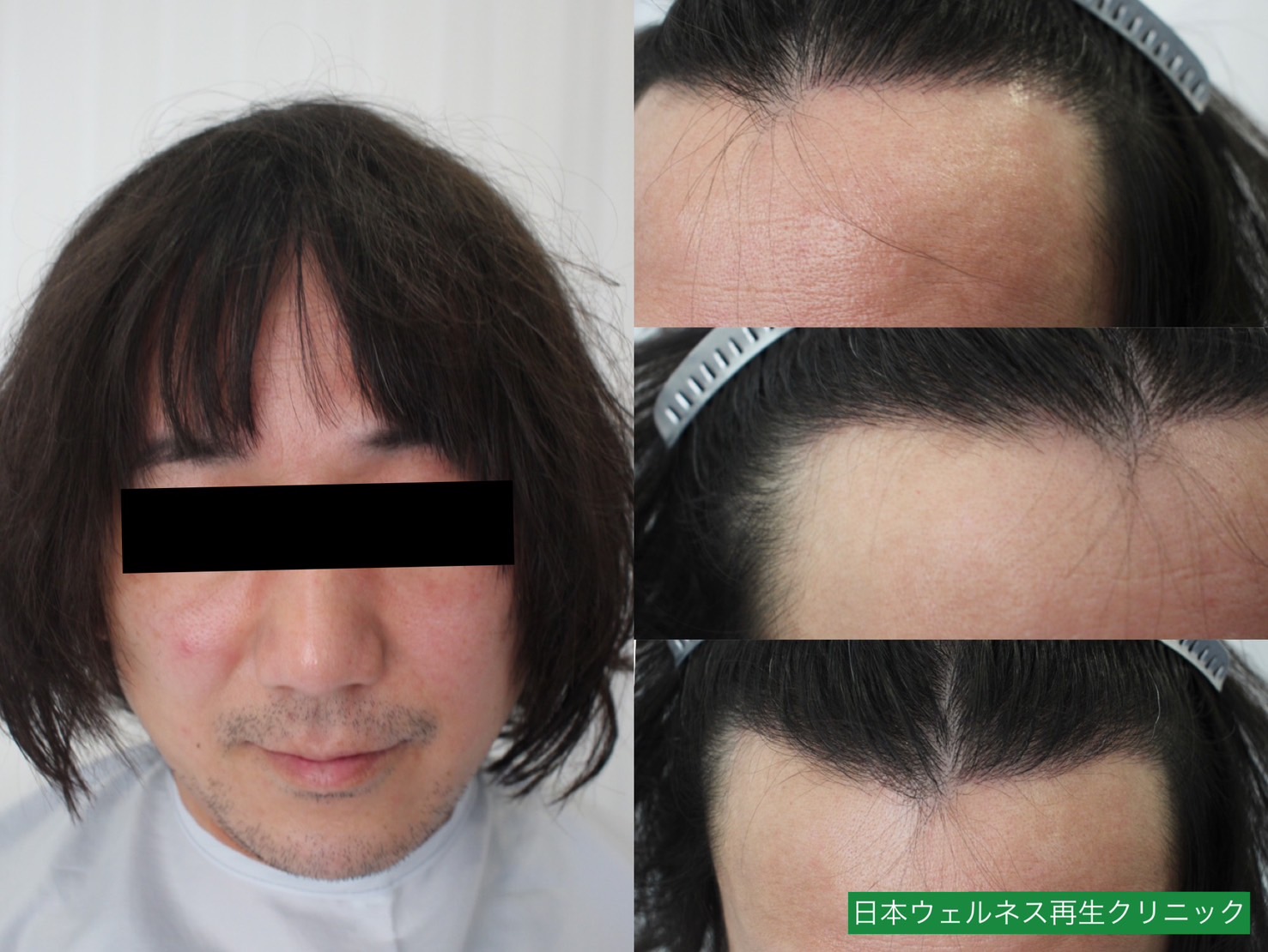 N・Sさん　40代男性【FUT】500株