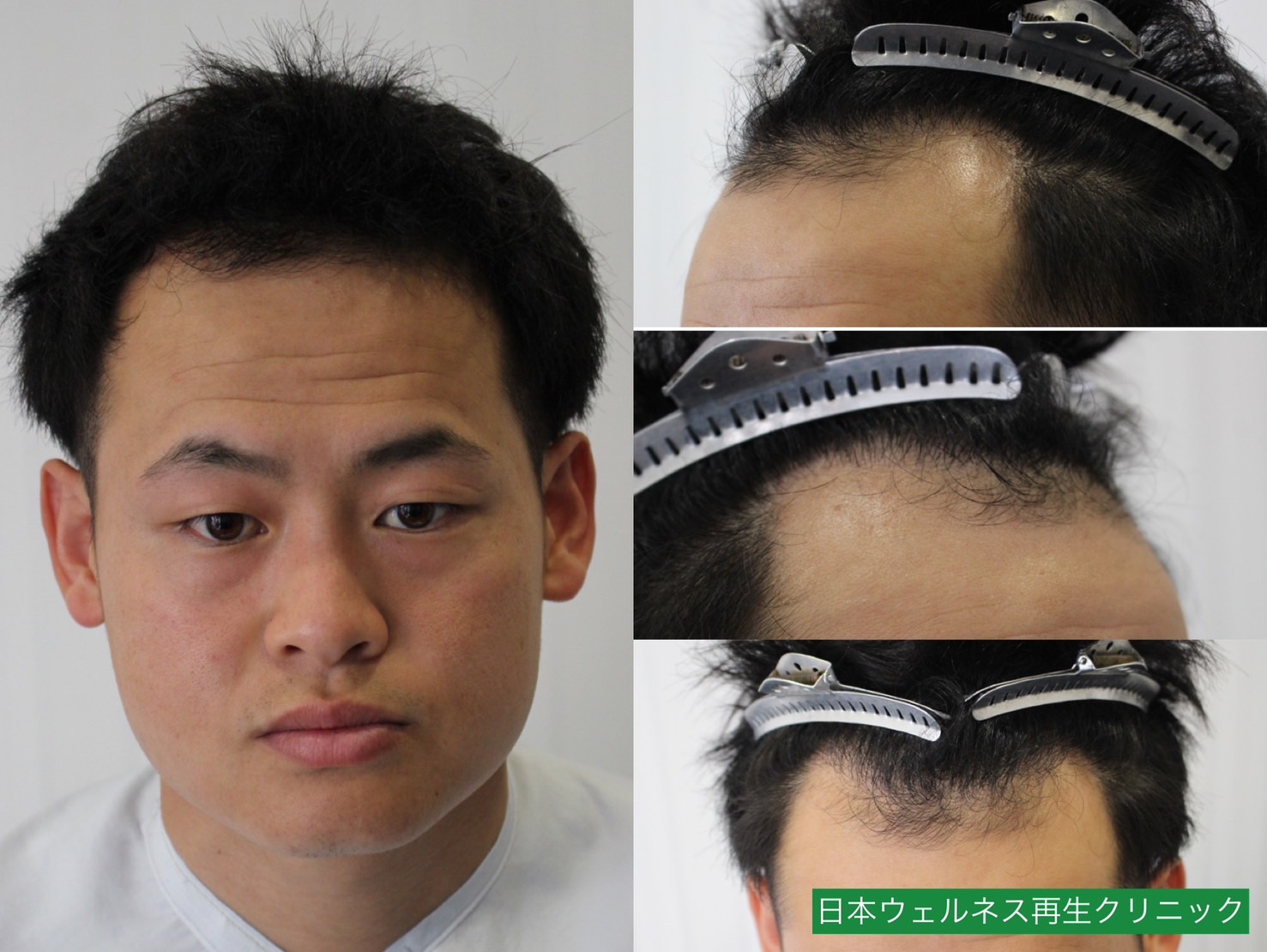 M・Tさん　20代男性【FUT】1200株